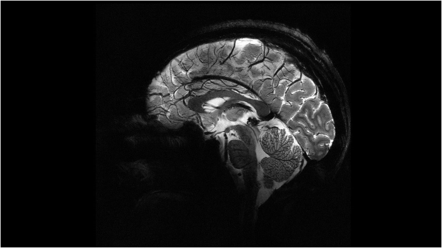 Une image du cerveau obtenue par l'IRM Iseult.